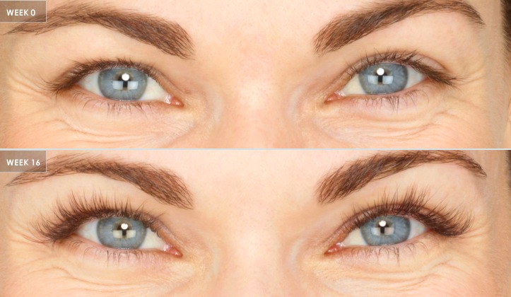 Lash length and fullness, close view — after treatment with Dr. Boris Zaks, MD, Beverly Hills
